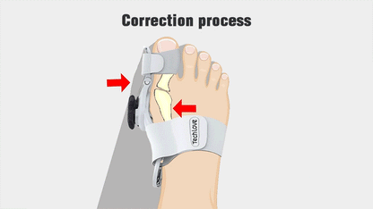 Korektor za Čukljeve